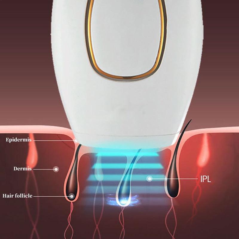Depilador Laser IPL Profissional Indolor - Luna Fashion Style -