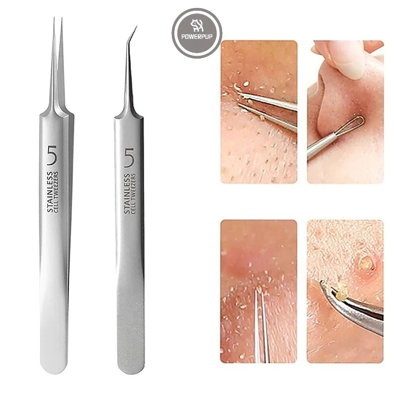 Kit Removedor de Cravos | 8 Peças - Luna Fashion Style -